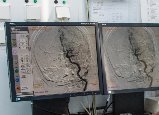 Инсульт меняет всю жизнь Инсульт меняет всю жизнь