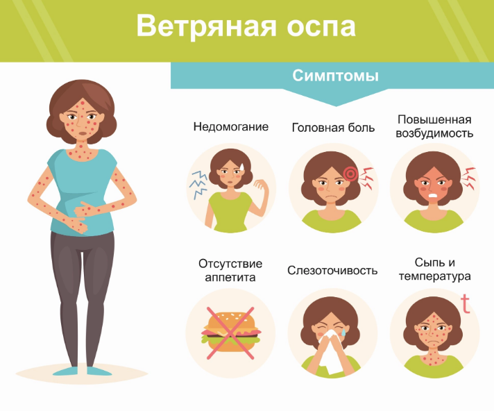 Как не подхватить ветрянку | Фотография 1