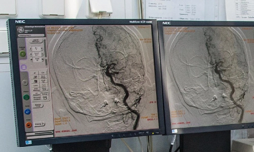 Инсульт меняет всю жизнь